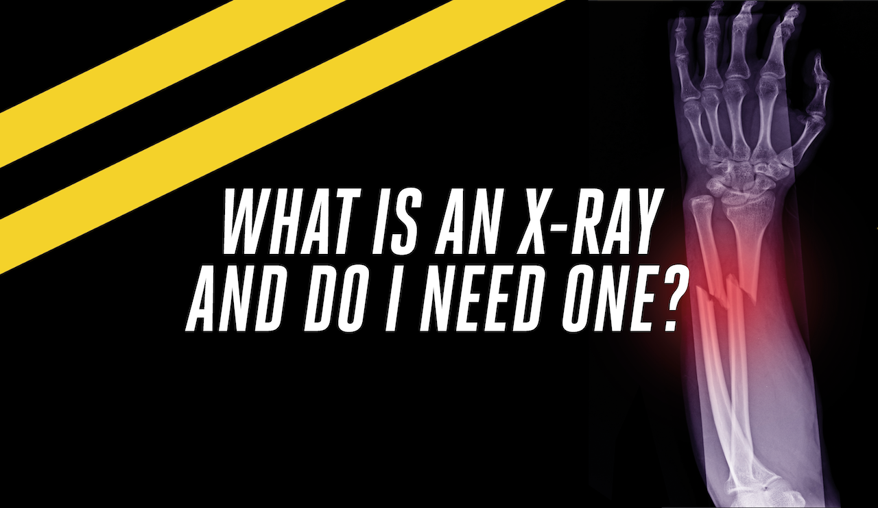 What Is An X-ray And Do I Need One?